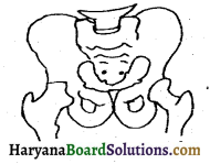 HBSE 6th Class Science Solutions Chapter 8 शरीर में गति -10